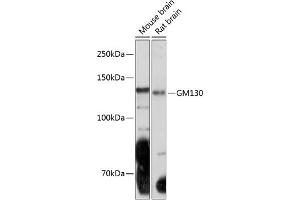 Western blot analysis of extracts of various cell lines, using GM130 Rabbit mAb (ABIN7267494) at 1:1000 dilution.