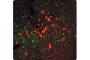 Tissue section through an adult Mouse brain showing TYH (red staining) in catecholaminergic neurons of the substantia nigra (pars compacta).