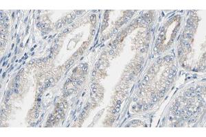 ABIN6269321 at 1/100 staining Human prostate tissue by IHC-P.