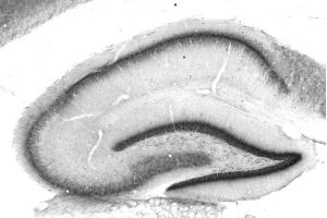 Adult rat hippocampus immunohistochemistry. (FGF14 anticorps  (AA 1-252))