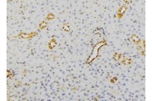 anti-RAB23, Member RAS Oncogene Family (RAB23) (C-Term) antibody