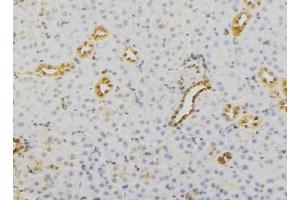 ABIN6279732 at 1/100 staining Mouse kidney tissue by IHC-P. (RAB23 anticorps  (C-Term))