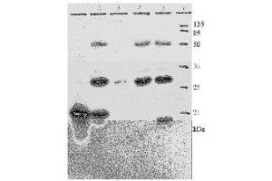Western Blotting (WB) image for anti-Human Papilloma Virus 18 E7 (HPV-18 E7) (AA 36-70) antibody (ABIN781778) (HPV18 E7 anticorps  (AA 36-70))