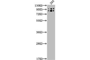 Western Blot Positive WB detected in: 293 whole cell lysate All lanes: BCHE antibody at 1:2000 Secondary Goat polyclonal to rabbit IgG at 1/50000 dilution Predicted band size: 69 kDa Observed band size: 90 kDa (Recombinant Butyrylcholinesterase anticorps)
