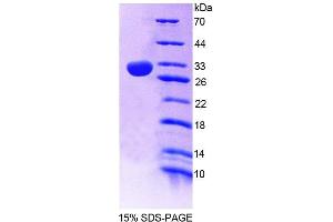SDS-PAGE analysis of Mouse PLCe1 Protein. (PLCE1 Protéine)