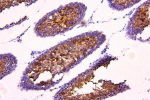 IHC analysis of ACACB using anti-ACACB antibody (ABIN7602757).