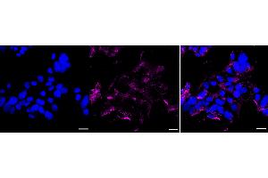 anti-Golgi Integral Membrane Protein 4 (GOLIM4) antibody