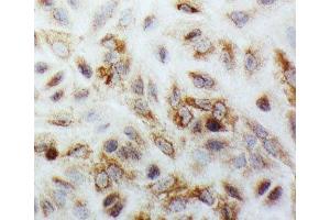 ICC testing of SMAD1 antibody and A549 cells (SMAD1 anticorps  (C-Term))