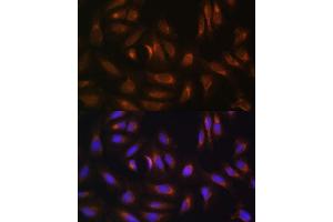 Immunofluorescence analysis of U-2 OS cells using NRBF2 antibody  at dilution of 1:100. (NRBF2 anticorps  (AA 10-220))