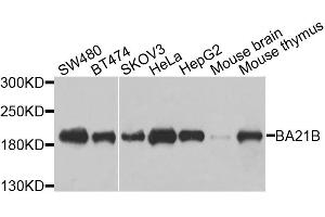 Western blot analysis of extracts of various cell lines, using BAZ1B antibody. (BAZ1B anticorps)