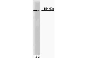 Western blot analysis of RAD50 on a Jurkat cell lysate (Human T-cell leukemia, ATCC TIB-152). (RAD50 anticorps  (AA 672-786))
