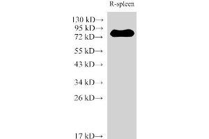 Western Blot analysis of Rat spleen using IL6R Polyclonal Antibody at dilution of 1:2000 (IL-6 Receptor anticorps)