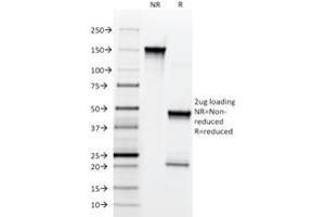 SDS-PAGE Analysis Purified NGFR Mouse Monoclonal Antibody (NGFR5). (NGFR anticorps)