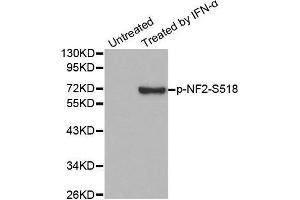 Western blot analysis of extracts from HUVEC cells, using Phospho-NF2-S518 antibody.