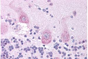 Human Brain, Cerebellum (formalin-fixed, paraffin-embedded) stained with CHRNA3 antibody ABIN214739 at 5 ug/ml followed by biotinylated goat anti-rabbit IgG secondary antibody ABIN481713, alkaline phosphatase-streptavidin and chromogen.
