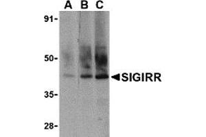 Western Blotting (WB) image for anti-Single Immunoglobulin and Toll-Interleukin 1 Receptor (TIR) Domain (SIGIRR) (C-Term) antibody (ABIN1030659)