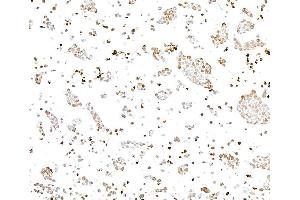 Immunocytochemistry (ICC) image for anti-gamma Histone Variant H2AX (GAMMA-H2AX) (Ser140) antibody (ABIN7454026) (Recombinant gamma H2AX anticorps  (Ser140))