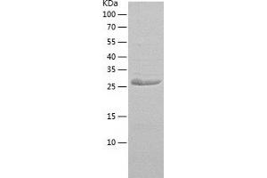 Western Blotting (WB) image for Zinc Finger Protein 184 (ZNF184) (AA 316-586) protein (His tag) (ABIN7125779)