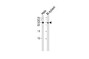 Western blot analysis of lysates from Hela cell line mouse spleen tissue lysate(from left to right), using TCF21 Antibody (C-term) (ABIN655524 and ABIN2845037).