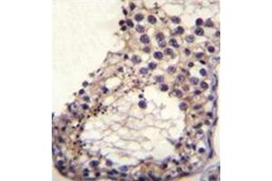 anti-Otoancorin (OTOA) (AA 99-127), (N-Term) antibody