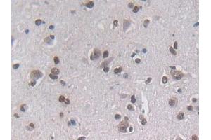 Detection of PLN in Human Cerebrum Tissue using Polyclonal Antibody to Phospholamban (PLN)