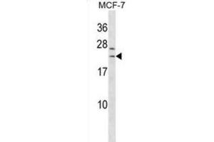 Western Blotting (WB) image for anti-SAP30-Like (SAP30L) antibody (ABIN3000391) (SAP30L anticorps)