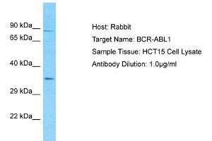 Host: Rabbit Target Name: BCR-ABL1 Sample Type: HCT15 Whole Cell lysates Antibody Dilution: 1. (Oncogene Protein p190/bcr-Abl (N-Term) anticorps)