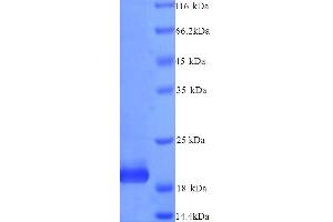 SDS-PAGE (SDS) image for TIMP Metallopeptidase Inhibitor 4 (TIMP4) (AA 30-224) protein (His tag) (ABIN5713896) (TIMP4 Protein (AA 30-224) (His tag))