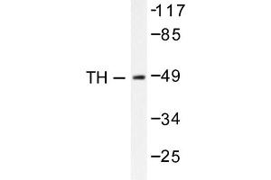 Image no. 1 for anti-Tyrosine Hydroxylase (TH) antibody (ABIN271856) (Tyrosine Hydroxylase anticorps)