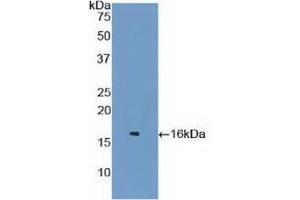 Detection of Recombinant LZM, Mouse using Polyclonal Antibody to Lysozyme (LZM) (LYZ anticorps  (AA 22-143))