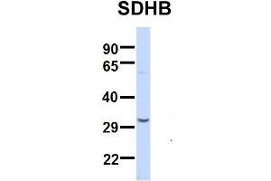 Host:  Rabbit  Target Name:  SERPINA3  Sample Type:  Human Adult Placenta  Antibody Dilution:  1. (SDHB anticorps  (Middle Region))