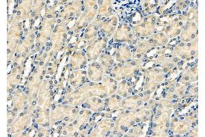 ABIN6262242 and ABIN6278080 at 1/100 staining Mouse kidney tissue by IHC-P. (HIPK2 anticorps  (N-Term))