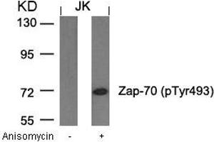 Western blot analysis of extracts from JK cells untreated or treated with anisomycin using Zap-70(Phospho-Tyr493) Antibody. (ZAP7 (pTyr493) anticorps)