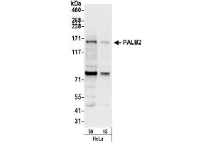 Western Blotting (WB) image for anti-Partner and Localizer of BRCA2 (PALB2) (AA 675-725) antibody (ABIN7454733)