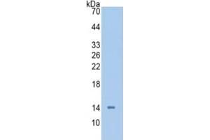 WB of Protein Standard: different control antibodies against Highly purified E. (SAA Kit ELISA)