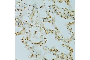 Immunohistochemistry of paraffin-embedded rat lung using RCC1 antibody. (RCC1 anticorps  (AA 1-240))