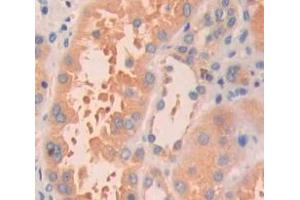 Used in DAB staining on fromalin fixed paraffin- embedded Kidney tissue (HRAS anticorps  (AA 82-176))