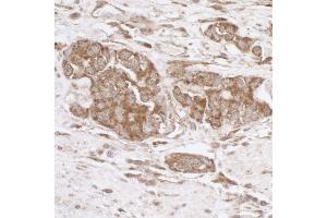 Immunohistochemistry (IHC) image for anti-TNF Receptor-Associated Protein 1 (TRAP1) (AA 600-650) antibody (ABIN7455063) (TRAP1 anticorps  (AA 600-650))