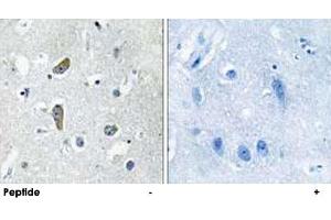 Immunohistochemistry analysis of paraffin-embedded human brain tissue using CDK5RAP2 polyclonal antibody . (CDK5RAP2 anticorps)