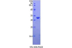 SDS-PAGE analysis of Human VRK1 Protein. (VRK1 Protéine)
