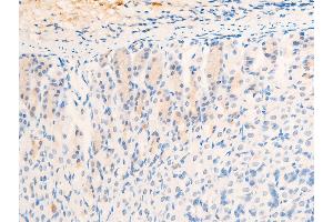 ABIN6267268 at 1/100 staining mouse gastric tissue sections by IHC-P. (EGFR anticorps  (pSer1026))