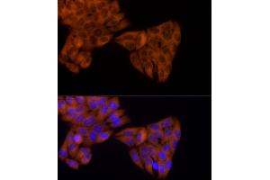 Immunofluorescence analysis of HeLa cells using KIF5B Rabbit mAb (ABIN7268135) at dilution of 1:25 (40x lens). (KIF5B anticorps)