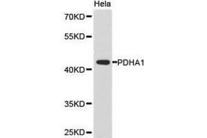 Western Blotting (WB) image for anti-Pyruvate Dehydrogenase (Lipoamide) alpha 1 (PDHA1) antibody (ABIN1874077) (PDHA1 anticorps)