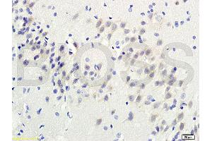 Formalin-fixed and paraffin-embedded : rat brain tissue labeled withRabbit Anti-TGM3 Polyclonal Antibody , Unconjugated, 1:200 followed by conjugation to the secondary antibody (TGM3 anticorps  (AA 601-693))