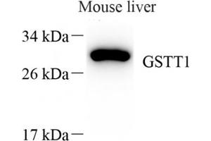 Western blot analysis of GSTT1 (ABIN7074091),at dilution of 1: 1000 (GSTT1 anticorps)