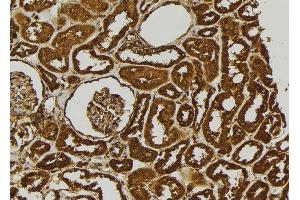 ABIN6279088 at 1/100 staining Human kidney tissue by IHC-P. (ADAMTS17 anticorps)