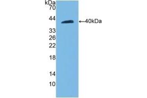 Detection of Recombinant CDH5, Rat using Polyclonal Antibody to Cadherin 5 (CDH5)