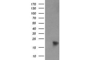 Image no. 8 for anti-NADH Dehydrogenase (Ubiquinone) 1 beta Subcomplex, 9, 22kDa (NDUFB9) (AA 3-179) antibody (ABIN1491360) (NDUFB9 anticorps  (AA 3-179))