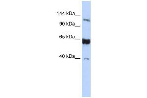 SYCP1 antibody used at 1 ug/ml to detect target protein. (SYCP1 anticorps  (N-Term))