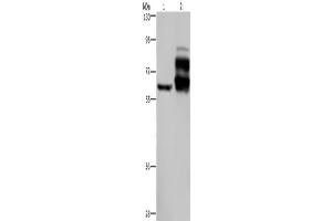 Western Blotting (WB) image for anti-Proprotein Convertase Subtilisin/kexin Type 9 (PCSK9) antibody (ABIN2435166) (PCSK9 anticorps)